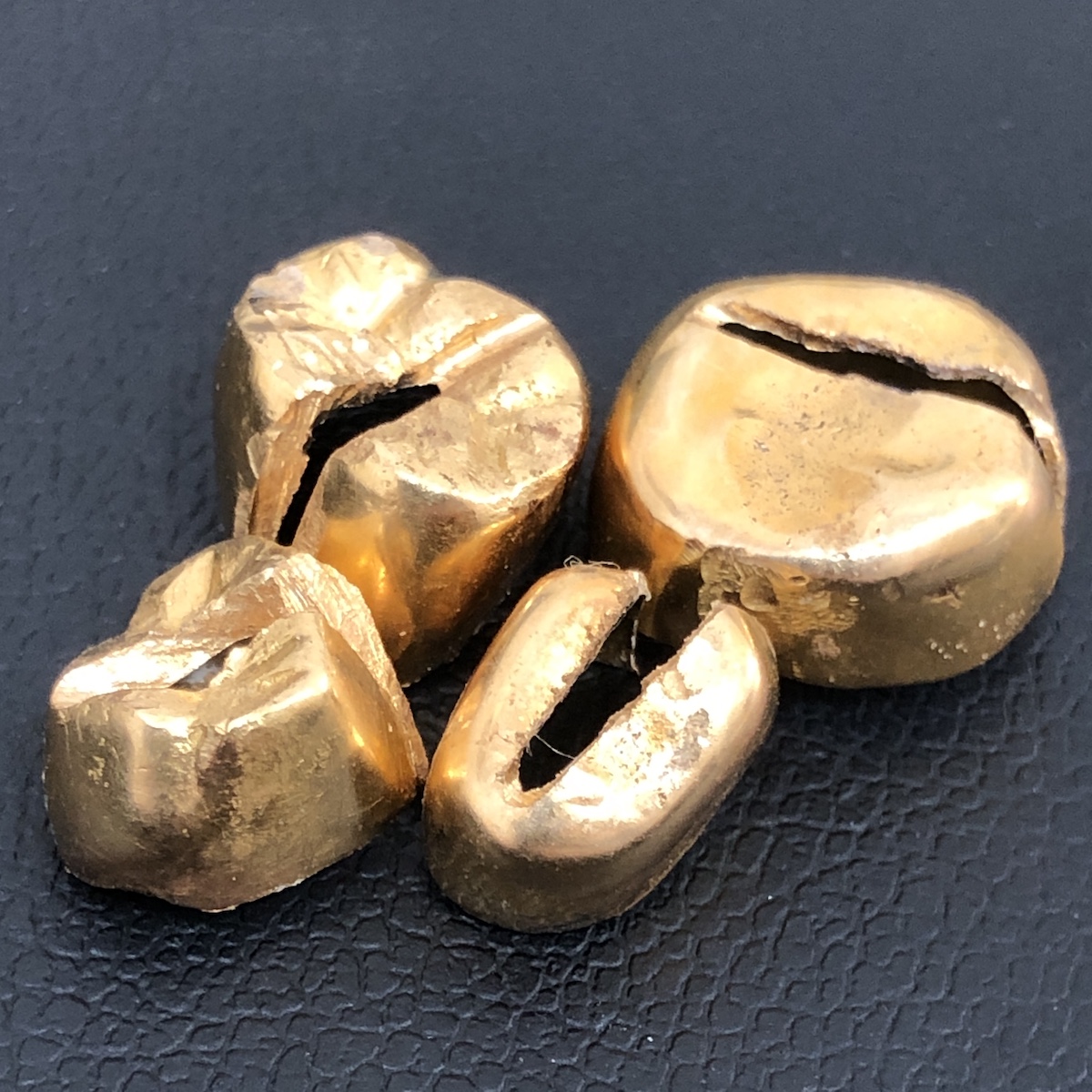 金歯画像